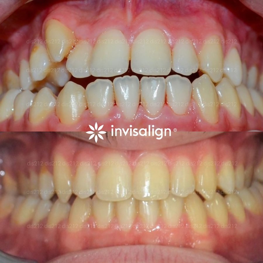 Dis 212 Dental Clinic - Ataturk Mahallesi - Dis 212 Dental Clinic - Ataturk Mahallesi