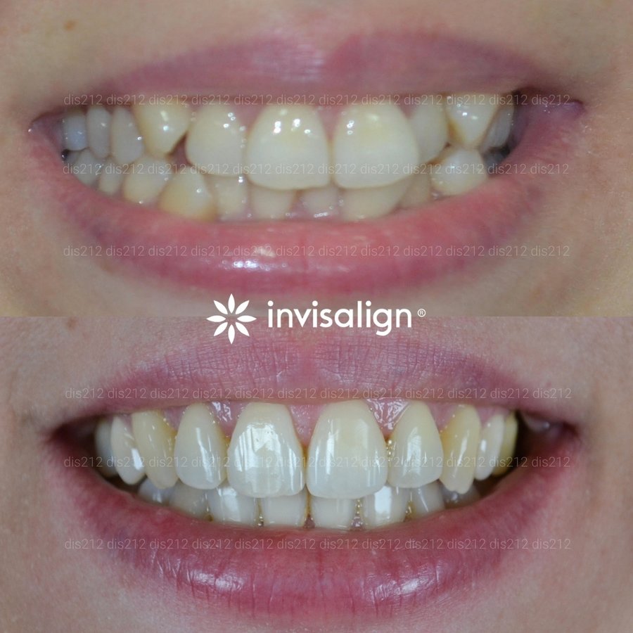 Dis 212 Dental Clinic - Ataturk Mahallesi - Dis 212 Dental Clinic - Ataturk Mahallesi