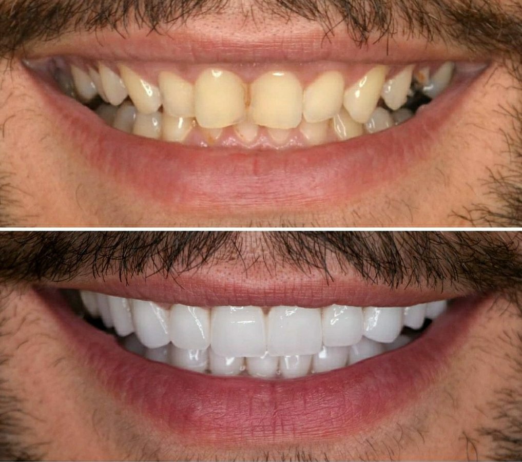 Dis 212 Dental Clinic - Ataturk Mahallesi - Dis 212 Dental Clinic - Ataturk Mahallesi