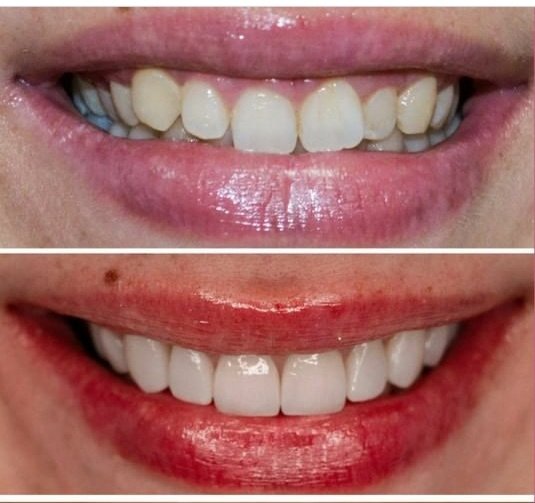 Dis 212 Dental Clinic - Ataturk Mahallesi - Dis 212 Dental Clinic - Ataturk Mahallesi