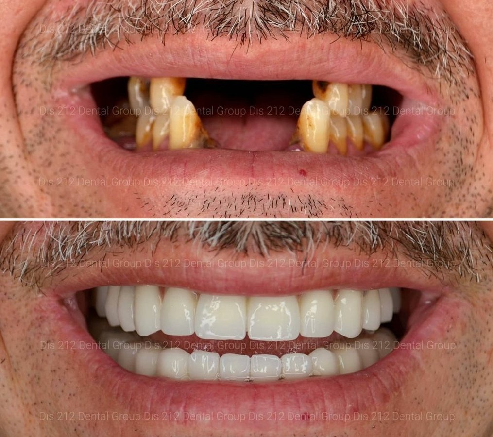 Dis 212 Dental Clinic - Ataturk Mahallesi - Dis 212 Dental Clinic - Ataturk Mahallesi