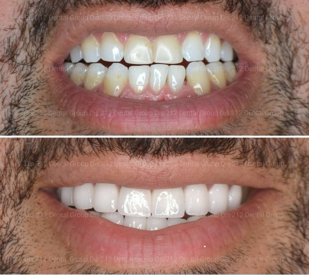 Dis 212 Dental Clinic - Ataturk Mahallesi - Dis 212 Dental Clinic - Ataturk Mahallesi