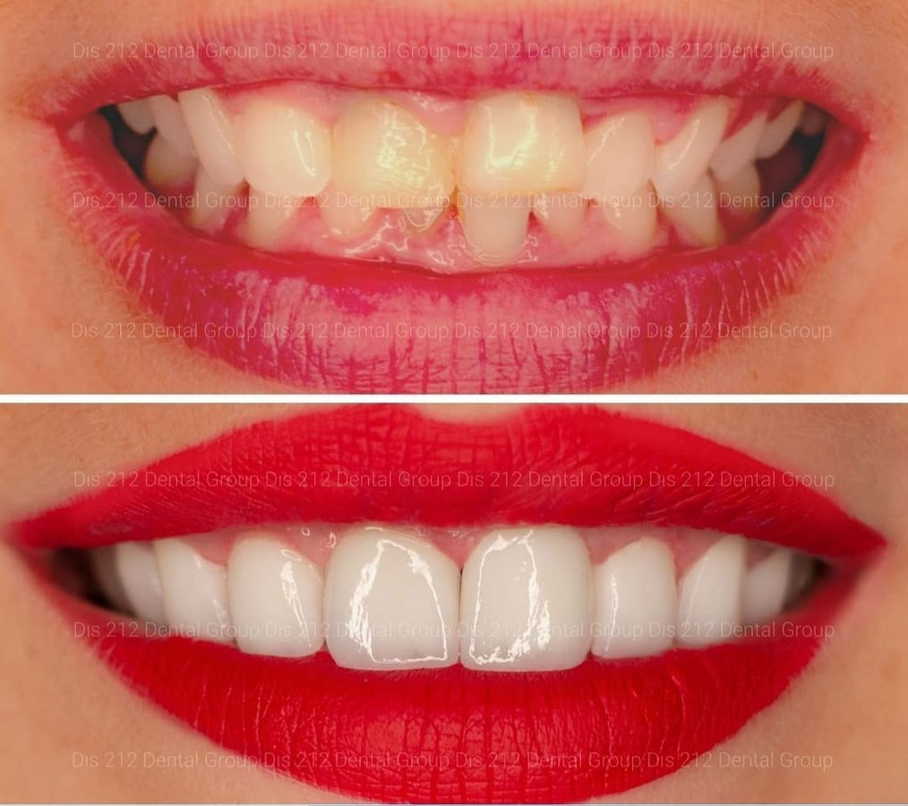 Dis 212 Dental Clinic - Ataturk Mahallesi - Dis 212 Dental Clinic - Ataturk Mahallesi