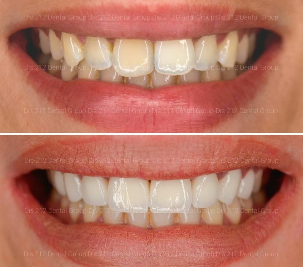 Dis 212 Dental Clinic - Ataturk Mahallesi - Dis 212 Dental Clinic - Ataturk Mahallesi