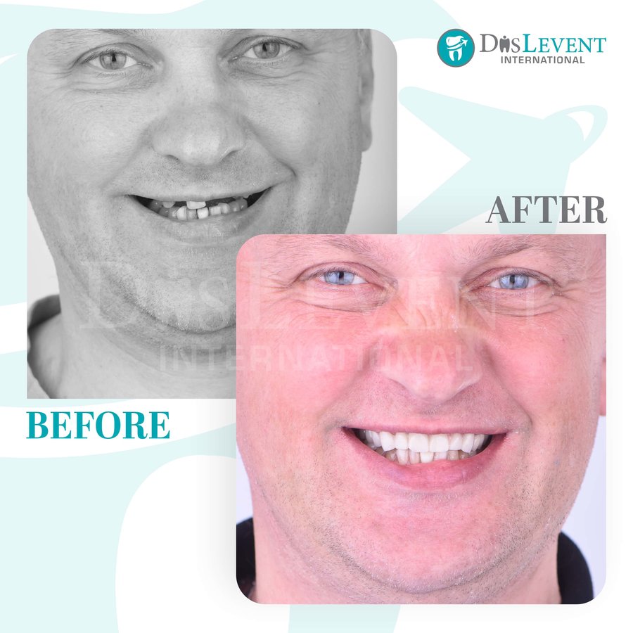 عيادة ديفينت الدولية - DIS Levent International Clinic