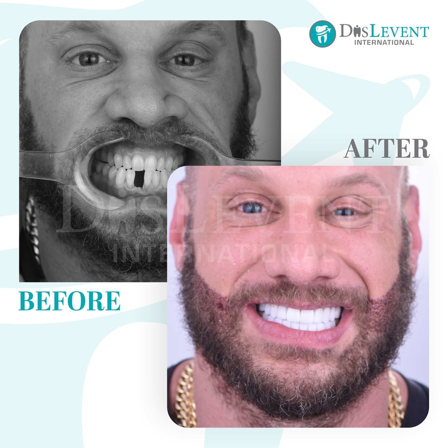 عيادة ديفينت الدولية - DIS Levent International Clinic