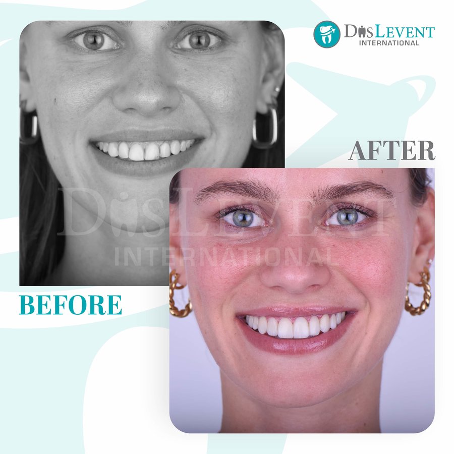 عيادة ديفينت الدولية - DIS Levent International Clinic