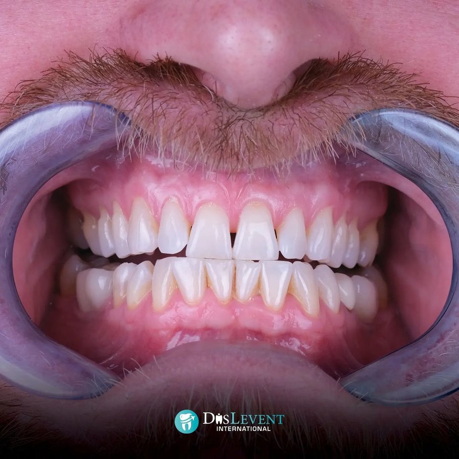 عيادة ديفينت الدولية - DIS Levent International Clinic