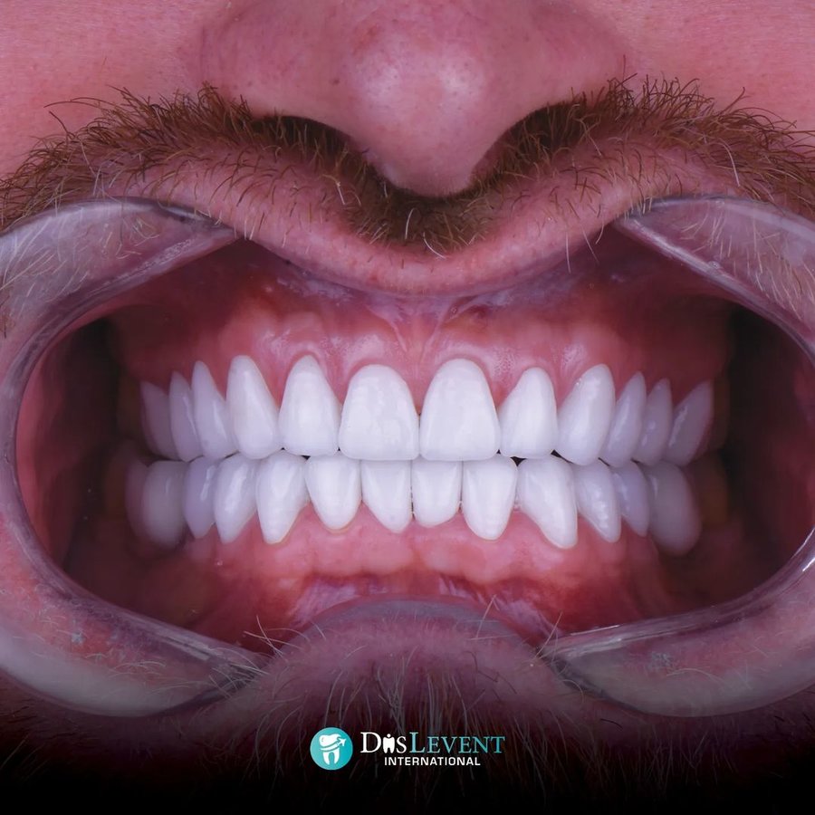 عيادة ديفينت الدولية - DIS Levent International Clinic