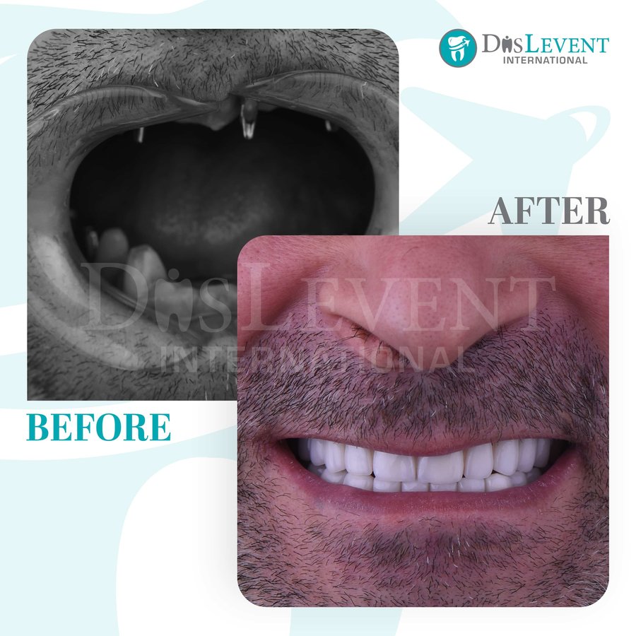 عيادة ديفينت الدولية - DIS Levent International Clinic