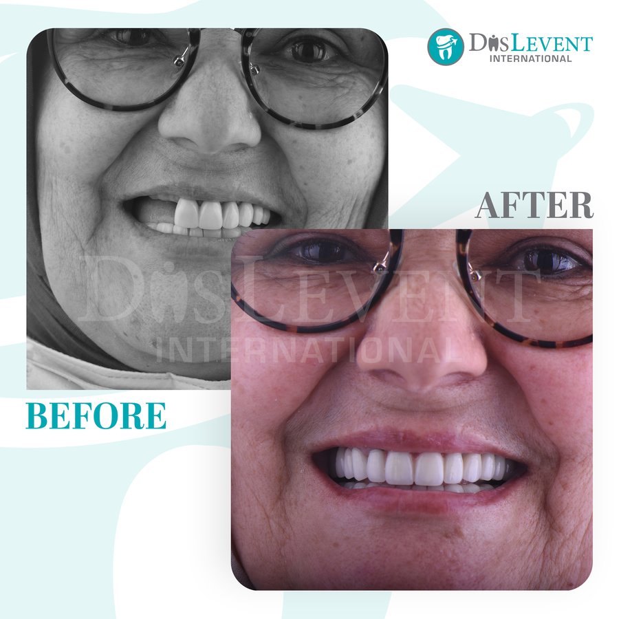 عيادة ديفينت الدولية - DIS Levent International Clinic