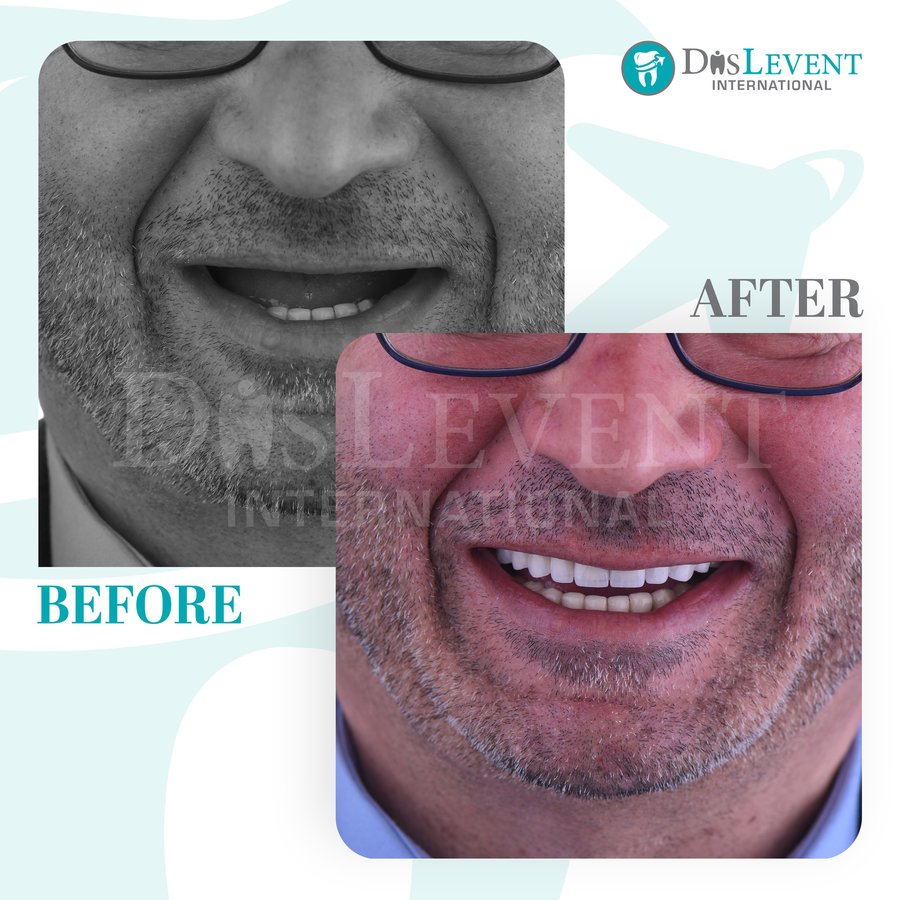 عيادة ديفينت الدولية - DIS Levent International Clinic