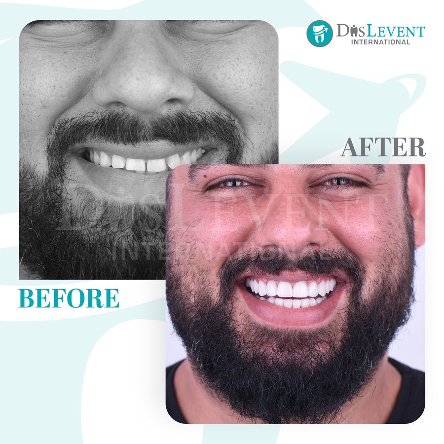 عيادة ديفينت الدولية - DIS Levent International Clinic