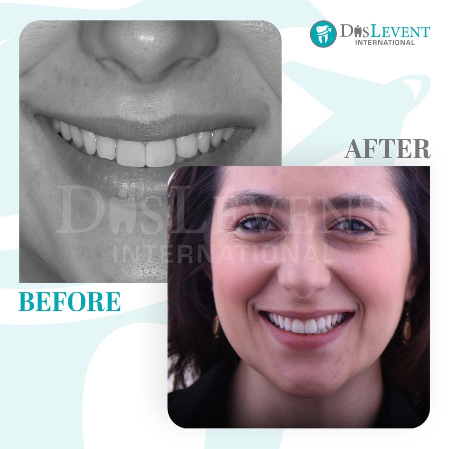 عيادة ديفينت الدولية - DIS Levent International Clinic