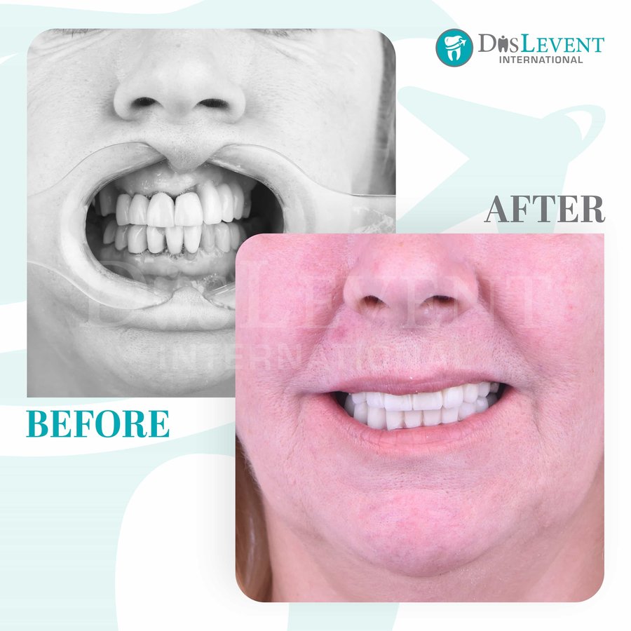 عيادة ديفينت الدولية - DIS Levent International Clinic