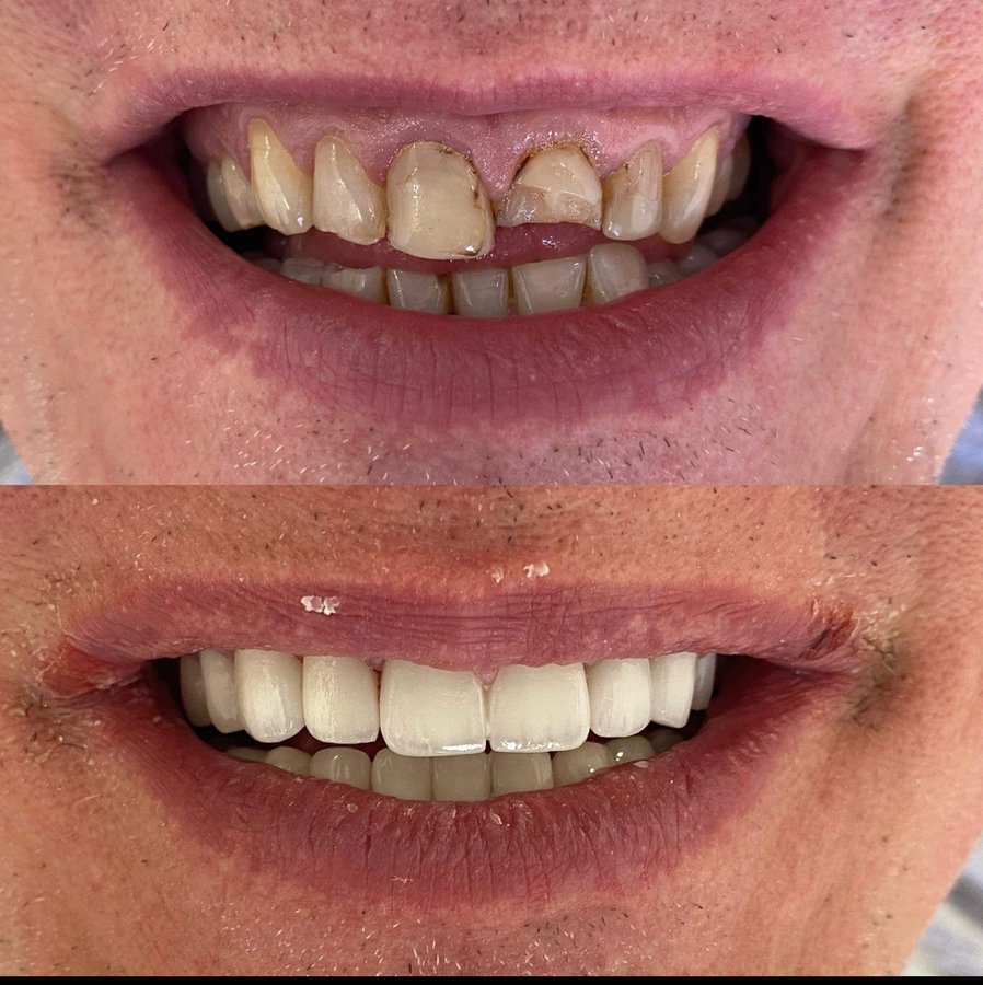 Dişhekimi Başak Balanlı Türkoğlu - Dişhekimi Başak Balanlı Türkoğlu