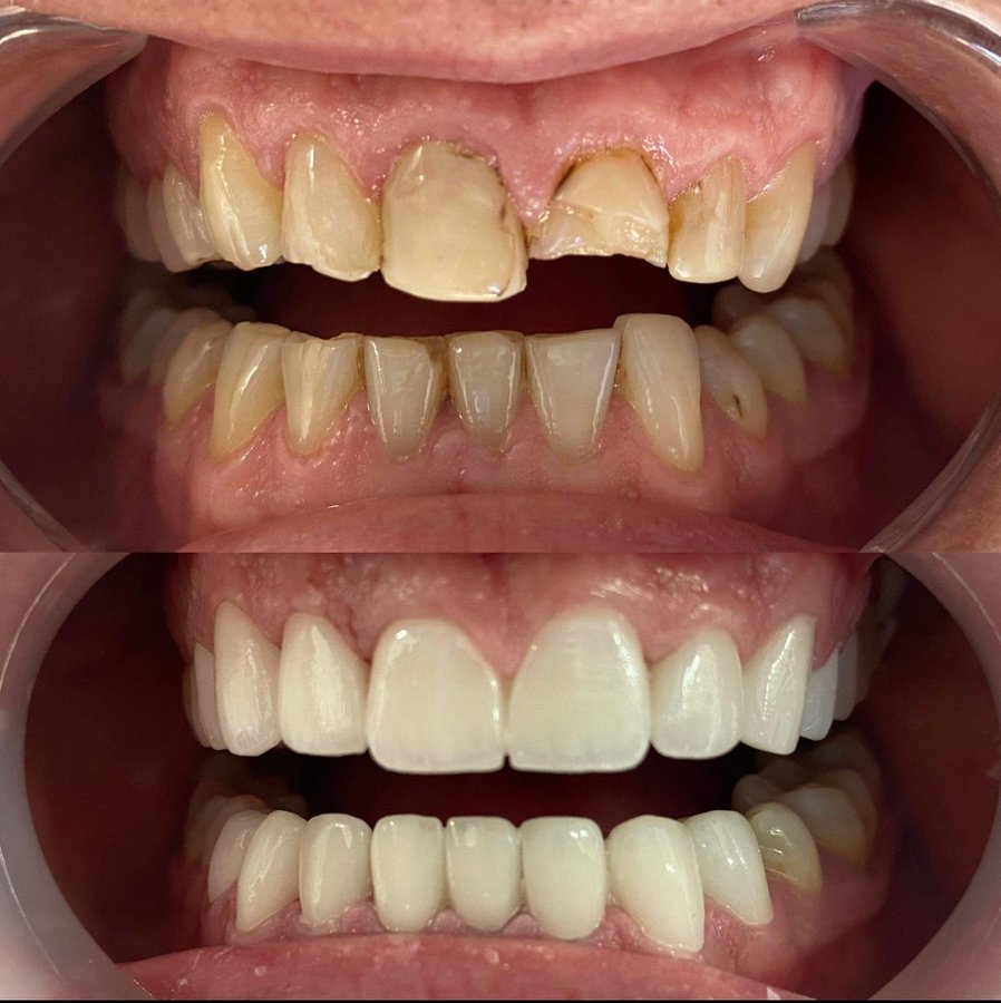 Dişhekimi Başak Balanlı Türkoğlu - Dişhekimi Başak Balanlı Türkoğlu