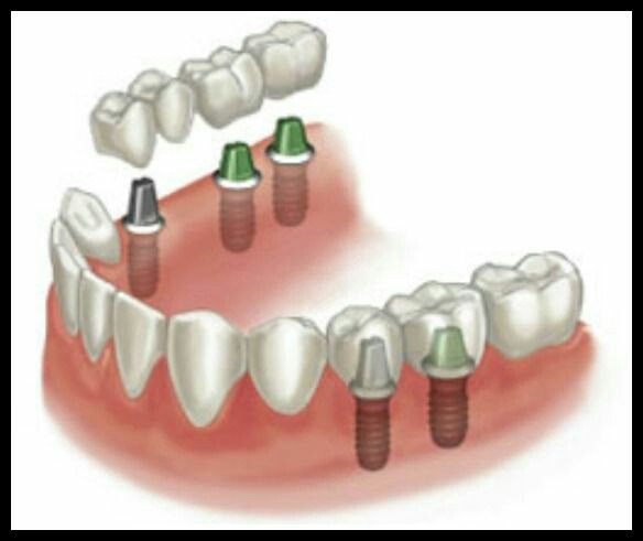 Diva Dental Care - Diva Dental Care