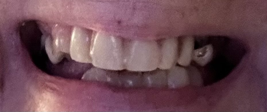 Divine Dentures - Divine Dentures