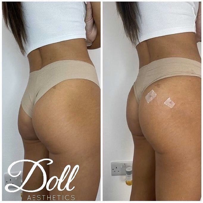 Doll Aesthetics London - Doll Aesthetics London