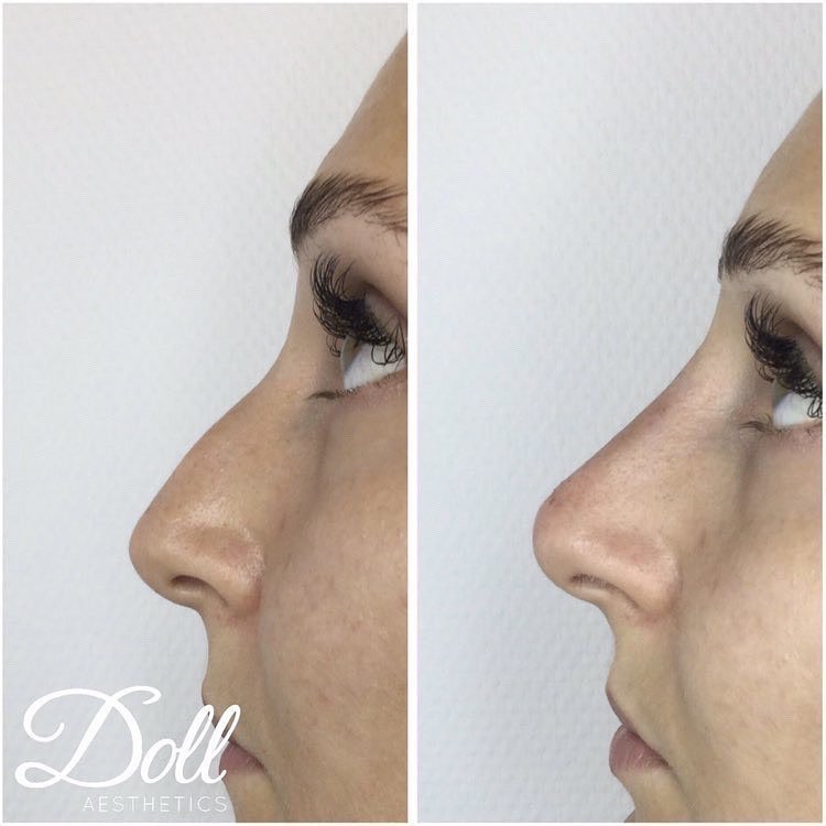 Doll Aesthetics London - Doll Aesthetics London