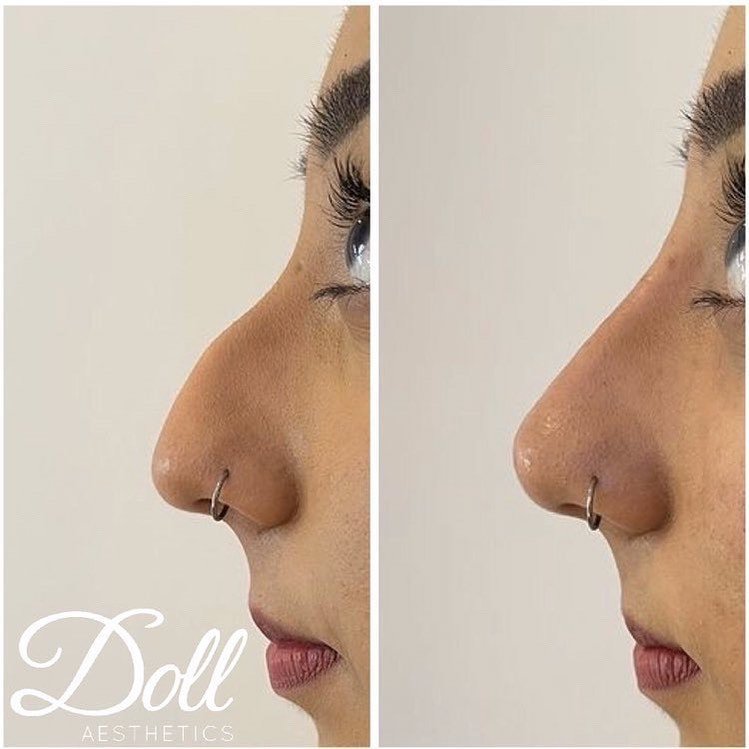 Doll Aesthetics London - Doll Aesthetics London