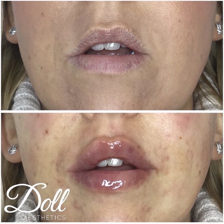 Doll Aesthetics London - Doll Aesthetics London