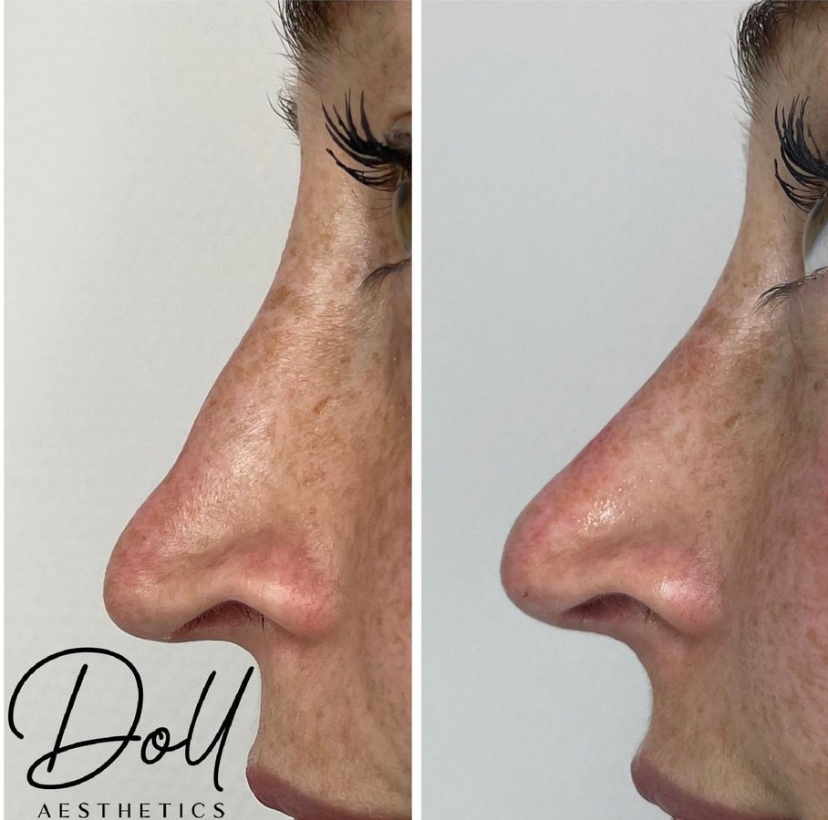 Doll Aesthetics London - Doll Aesthetics London