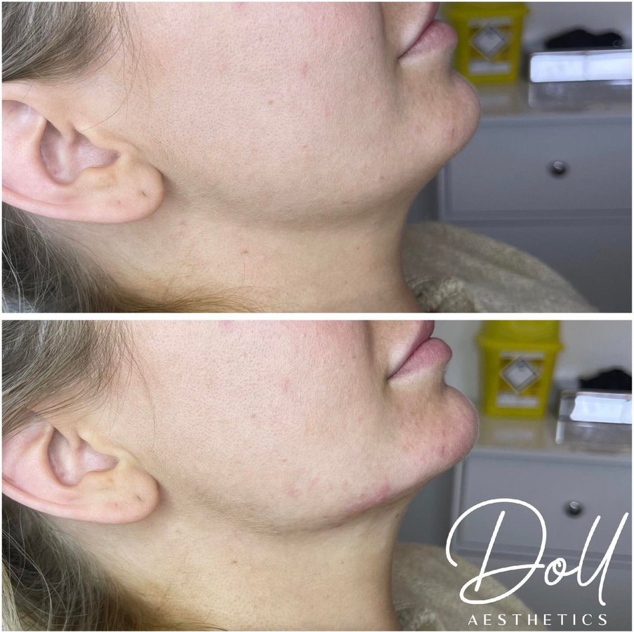 Doll Aesthetics London - Doll Aesthetics London