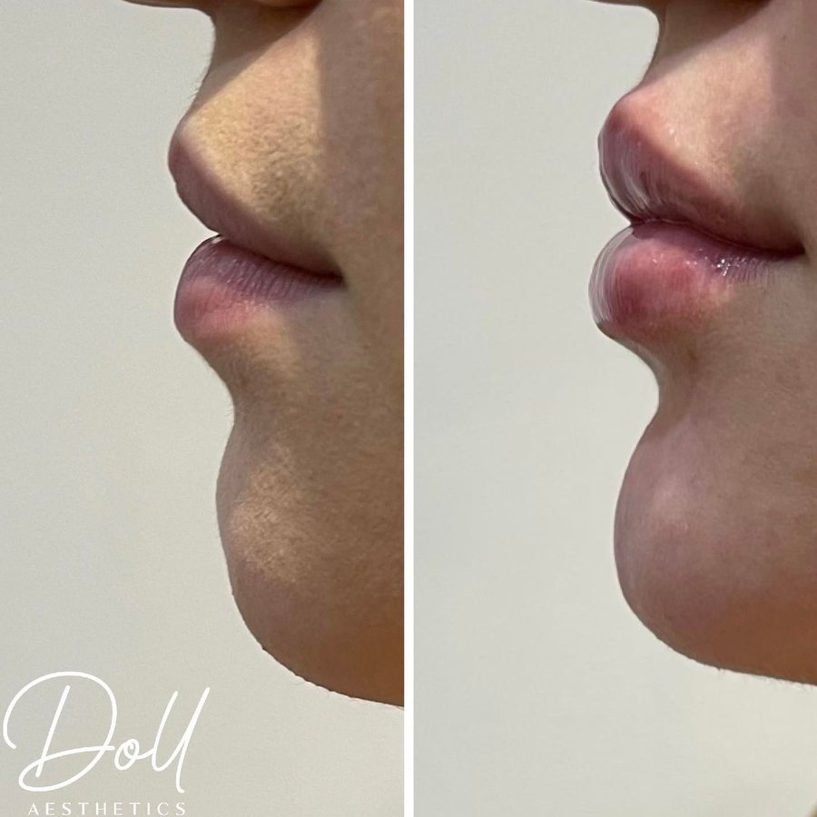 Doll Aesthetics London - Doll Aesthetics London