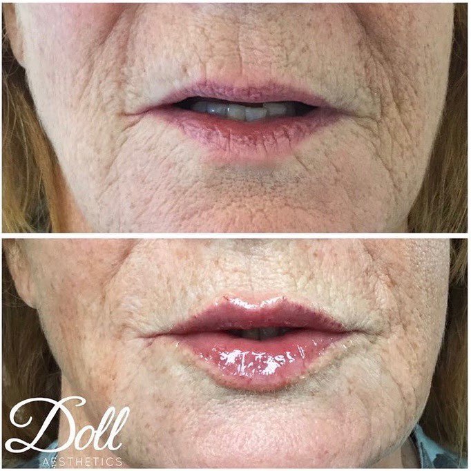 Doll Aesthetics London - Doll Aesthetics London