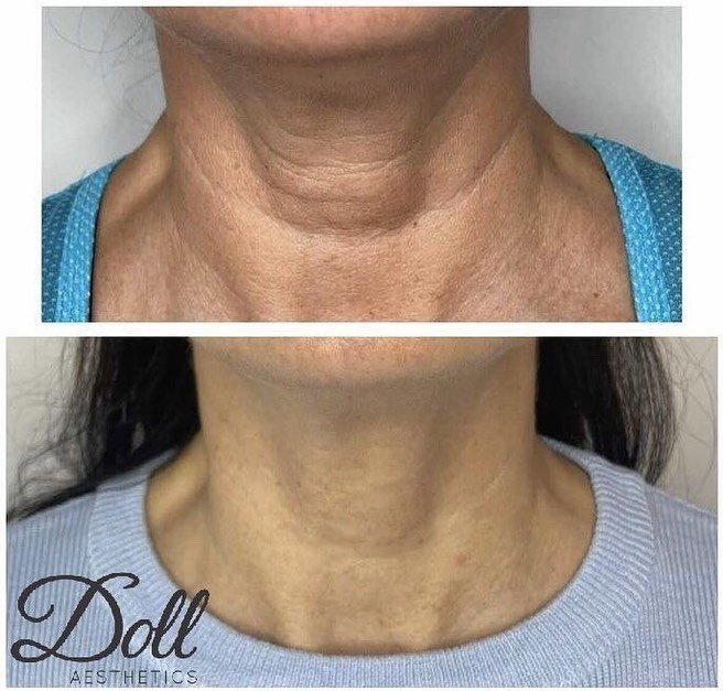Doll Aesthetics London - Doll Aesthetics London