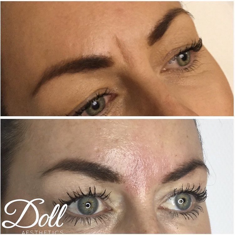 Doll Aesthetics London - Doll Aesthetics London