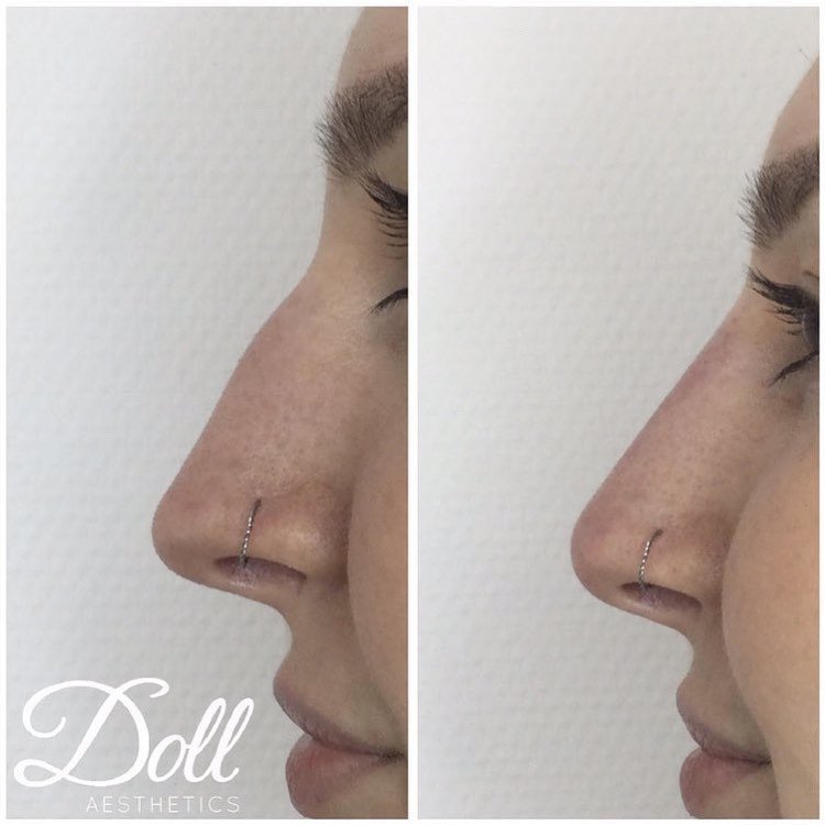 Doll Aesthetics London - Doll Aesthetics London