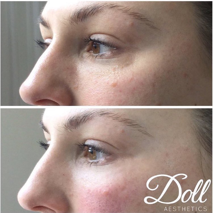 Doll Aesthetics London - Doll Aesthetics London