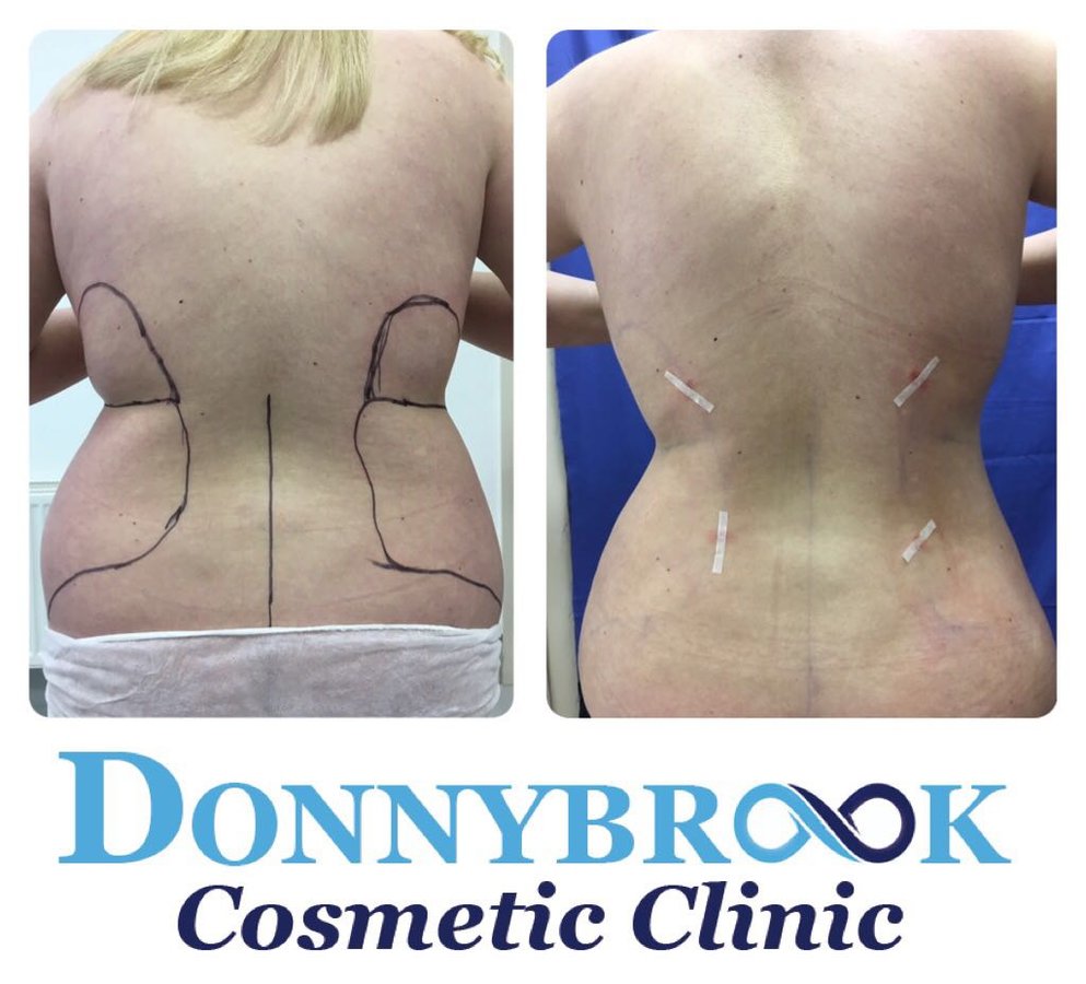 عيادة دونيبروك لمستحضرات التجميل والعافية - Donnybrook Cosmetic and Wellness Clinic