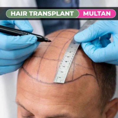 Dot Clinics - Hair Transplant Clinic - Dot Clinics