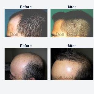 Dott. Riccardo Lucchesi - Studio Roma - Dott. Riccardo Lucchesi - Studio Roma