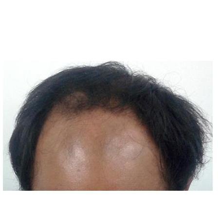 Downtown Hair Transplant Clinic - Downtown Hair Transplant Clinic