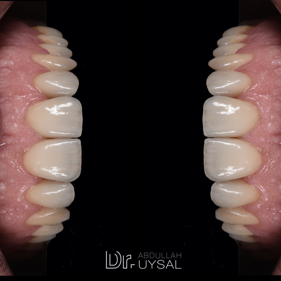 Dr. Abdullah UYSAL - Dr. Abdullah UYSAL