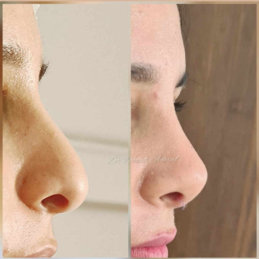 Dr. Achraf Daoud - Dr. Achraf Daoud