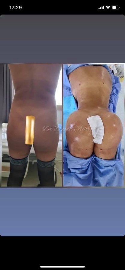 Dr. Achraf Daoud - Dr. Achraf Daoud