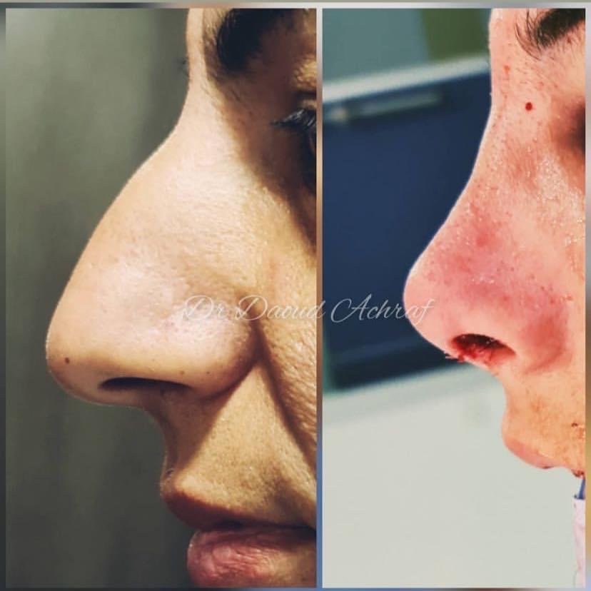 Dr. Achraf Daoud - Dr. Achraf Daoud