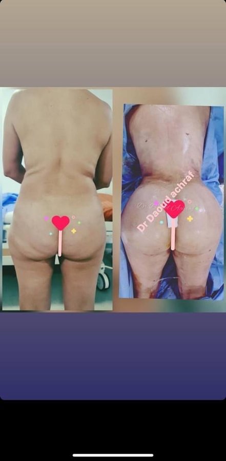 Dr. Achraf Daoud - Dr. Achraf Daoud