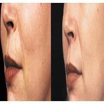 Dr. Acky Friedman - Dermatology and Aesthetics - Dr. Acky Friedman - Dermatology and Aesthetics