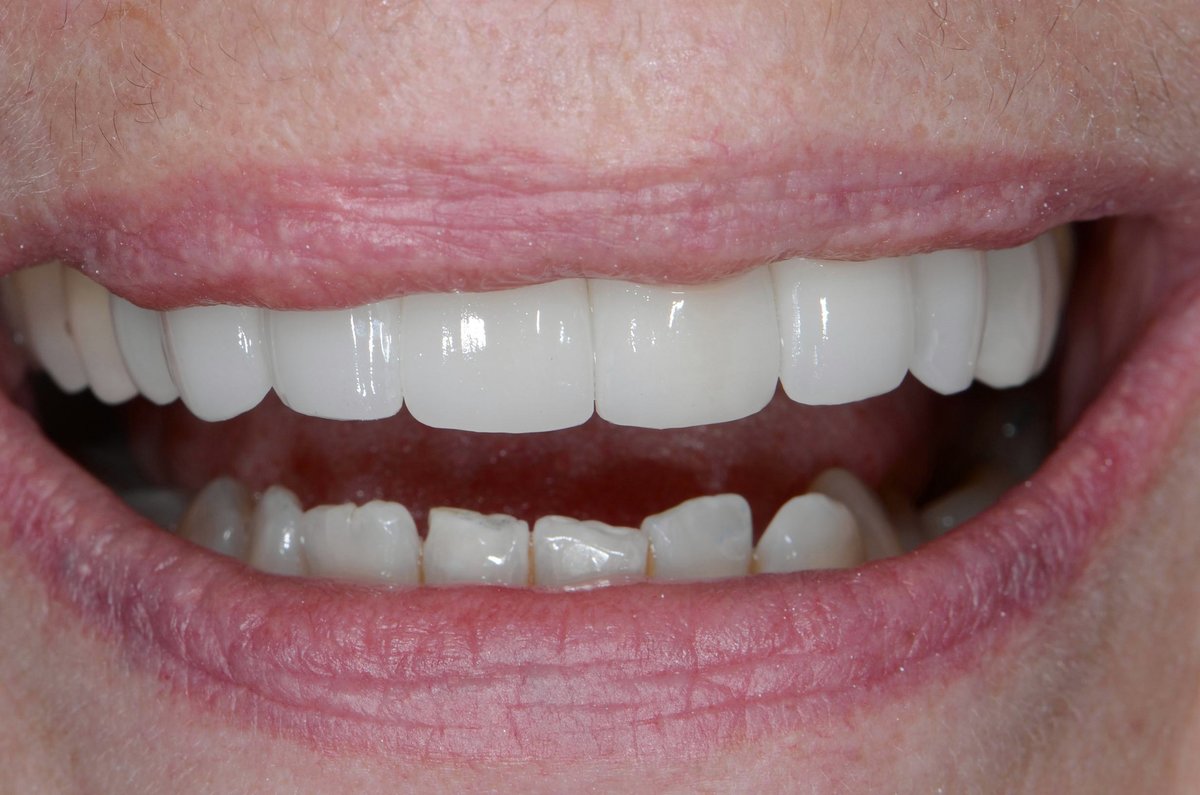 Dr. Adé Meyer Cosmetic Dentistry - Dr. Adé Meyer Cosmetic Dentistry