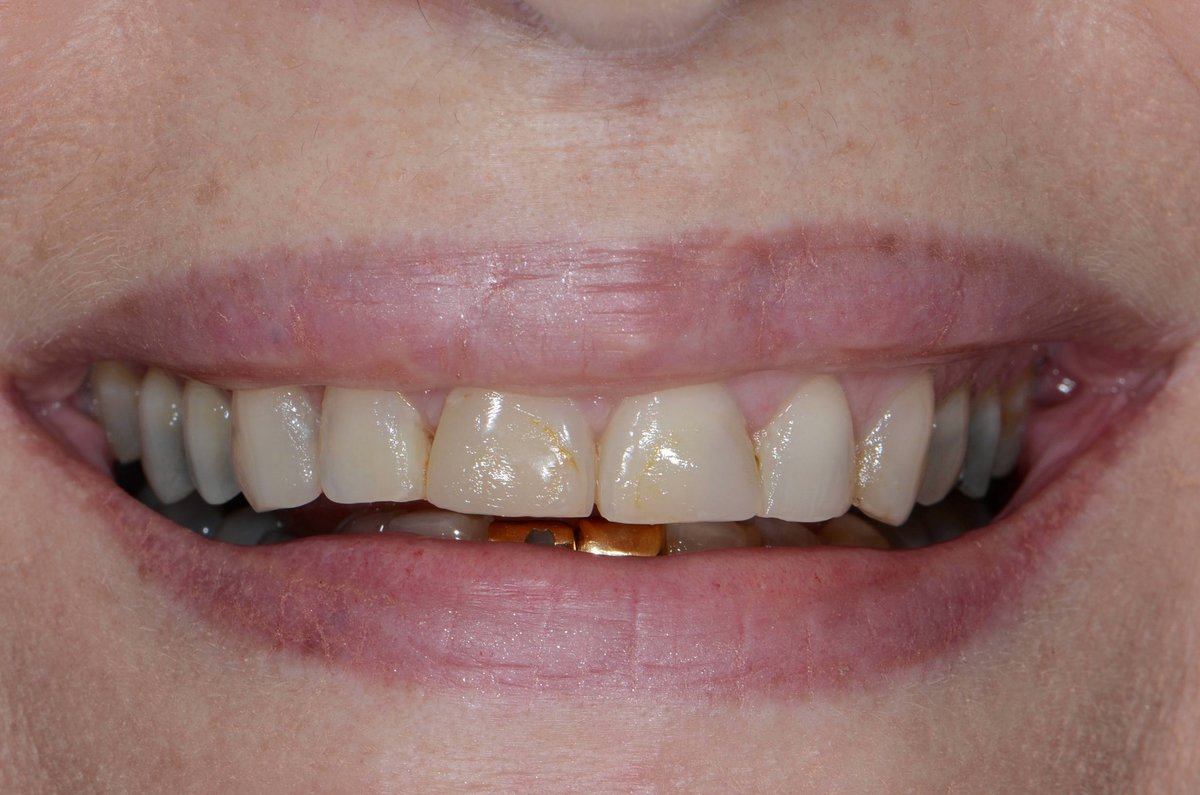 Dr. Adé Meyer Cosmetic Dentistry - Dr. Adé Meyer Cosmetic Dentistry