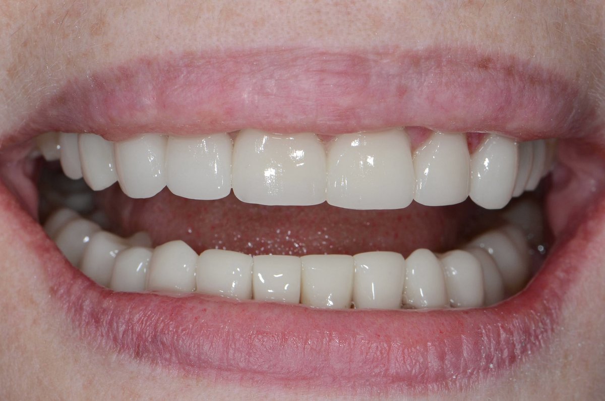 Dr. Adé Meyer Cosmetic Dentistry - Dr. Adé Meyer Cosmetic Dentistry