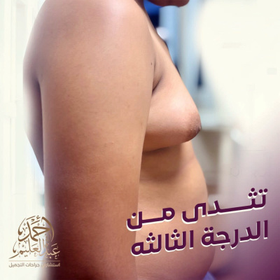 Dr Ahmed AbdelAlem Plastic Surgery Clinic - Dr Ahmed AbdelAlem Plastic Surgery Clinic