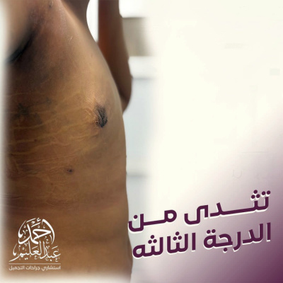 Dr Ahmed AbdelAlem Plastic Surgery Clinic - Dr Ahmed AbdelAlem Plastic Surgery Clinic